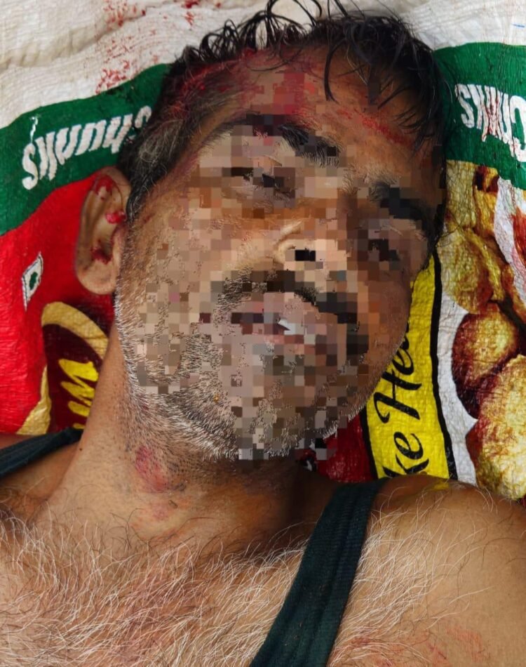 रेलवे ट्रैक पर ट्रेन से कटकर युवक ने की आत्महत्या