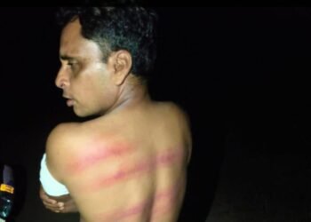 ट्रक चालक पर दबंगों का हमला, डंडे-बेल्ट से बेरहमी से पिटाई -जान से मारने की दी धमकी