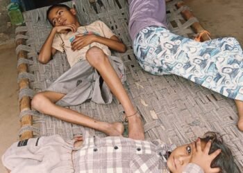 गंदगी और जलभराव से फैला बुखार, दर्जनों बीमार